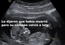 Hospital en el centro de la polémica tras caso de madre que estuvo a punto de perder su bebe en su vientre